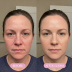 Pink Collagen Volume Balm Stick