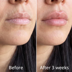 Pink Collagen Volume Balm Stick